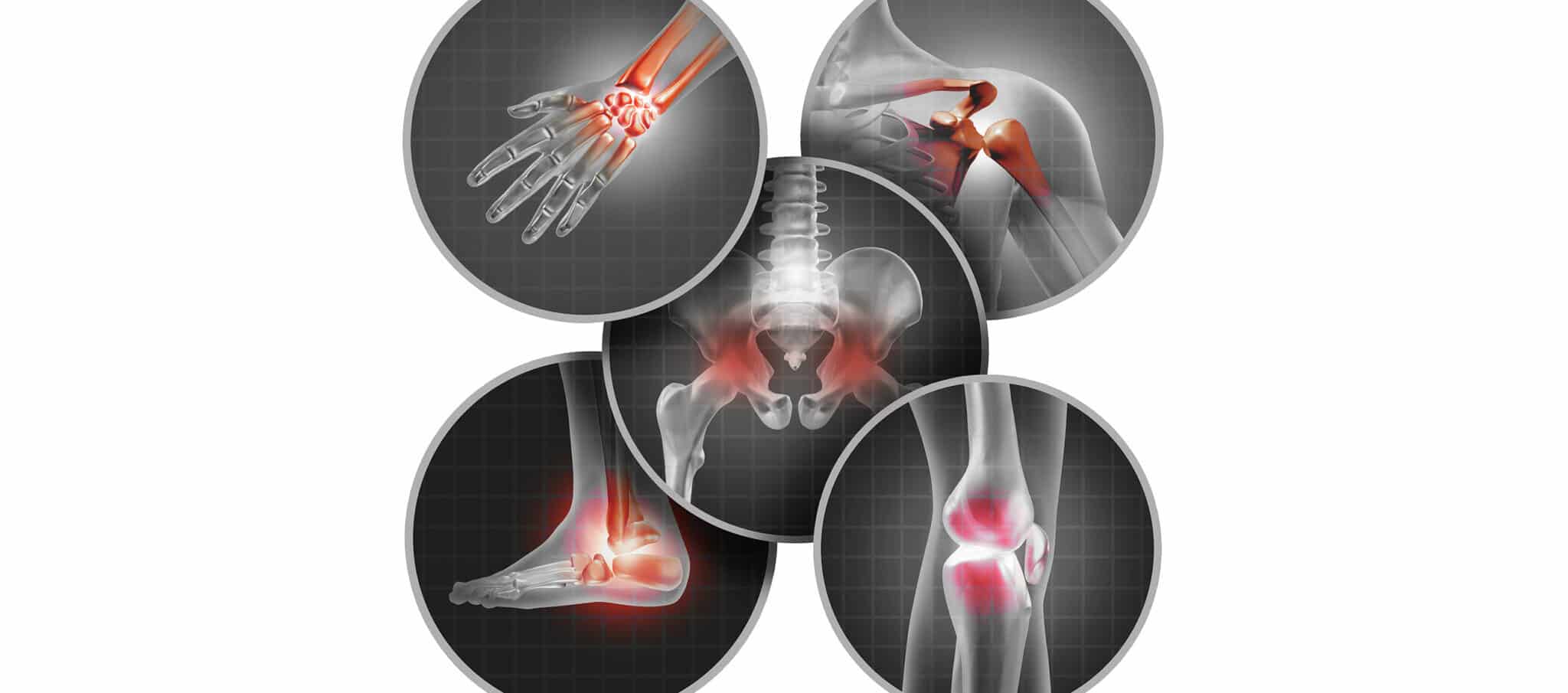 What Causes Wear And Tear Arthritis