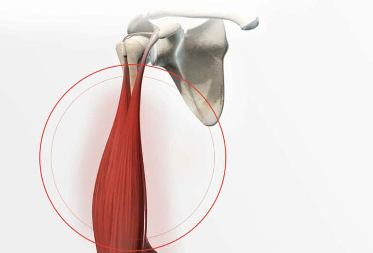 Symptômes et diagnostic de la tendinite du long biceps Dr Paillard