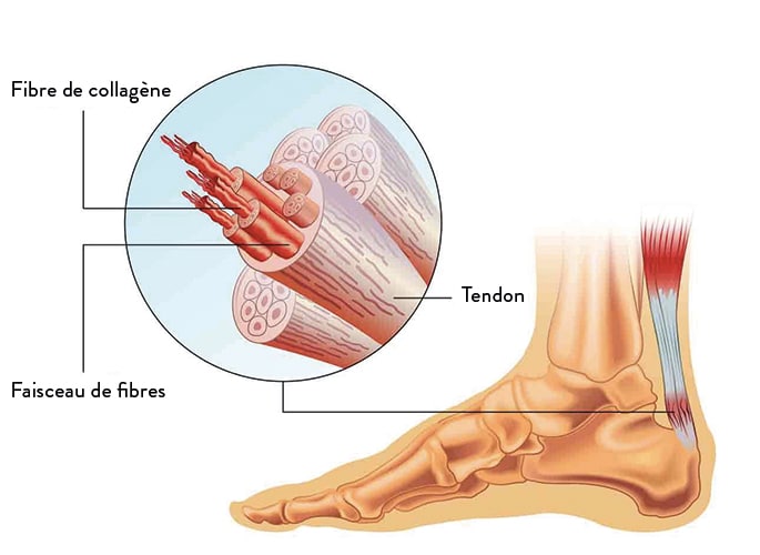 Tendinite Talon d'Achille Inflammation Douleurs Strapping Chevillère