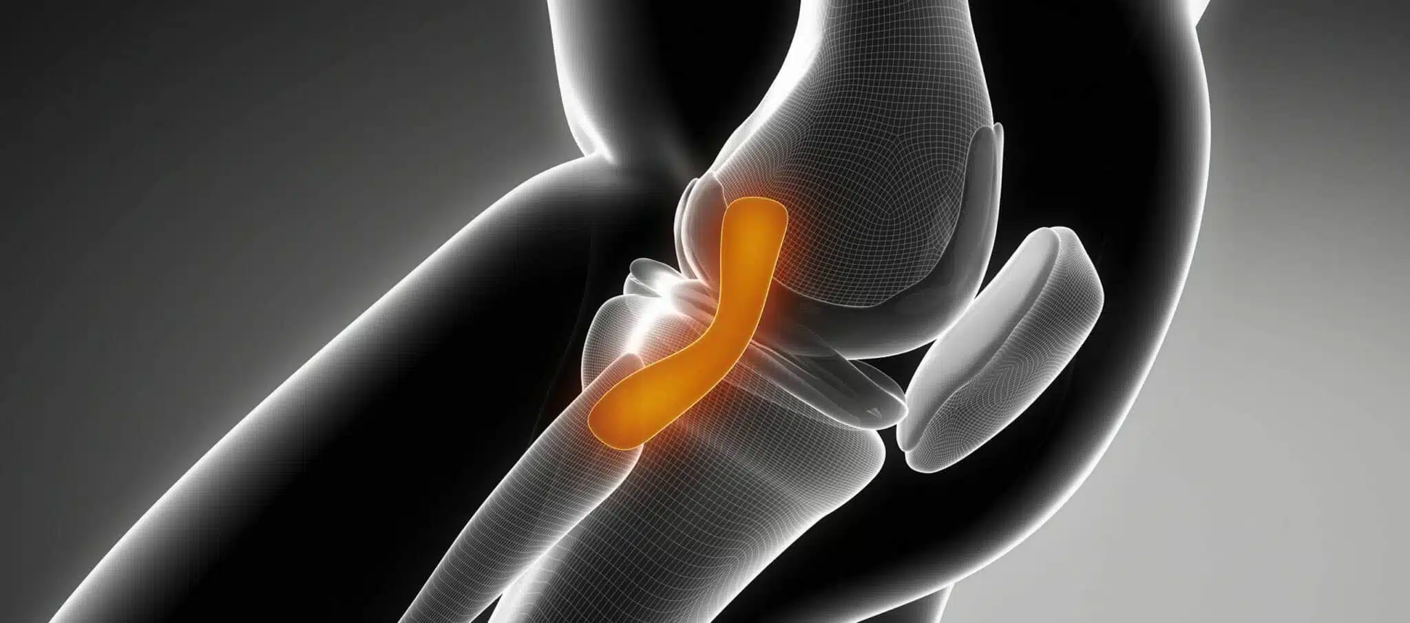 Conduire après une ligamentoplastie, informations sur la rééducation | Dr Paillard