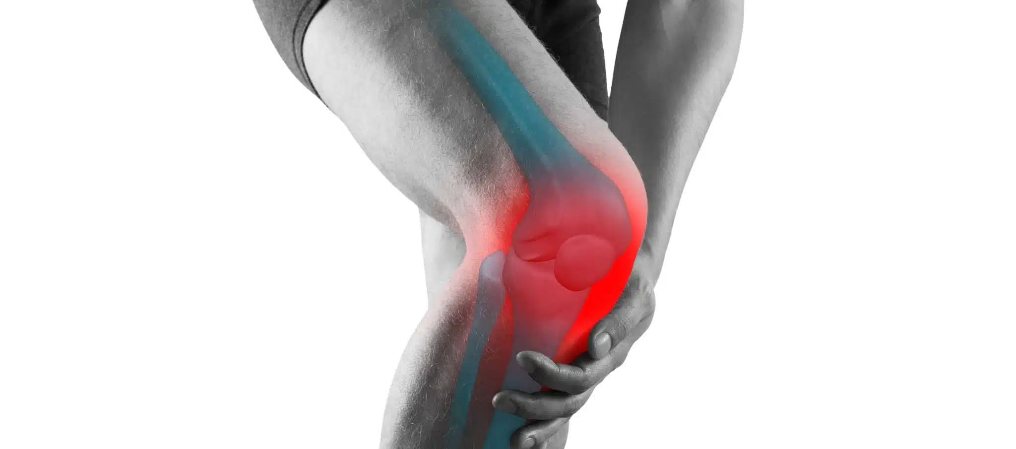 Comment soulager l’arthrose du genou ? | Dr Paillard | Paris