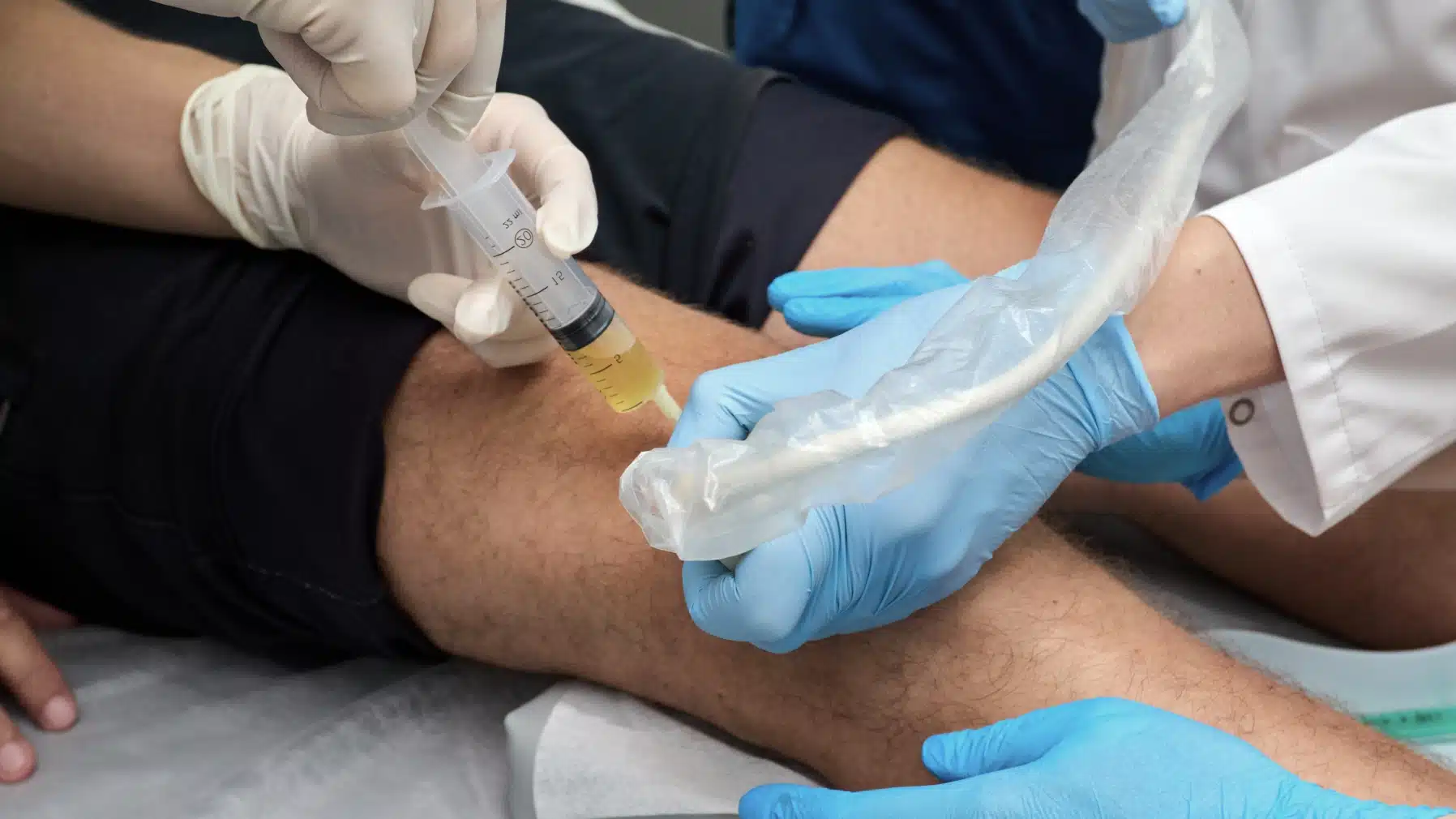 Lipogems : Traitement régénératif avec cellules mésenchymateuses | Dr Paillard | Paris 16