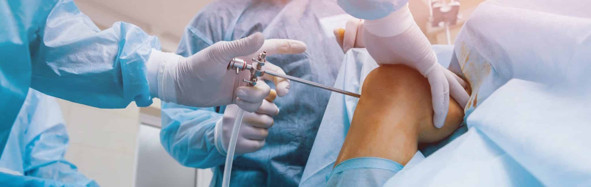 Arthroscopie du genou avec le Dr Paillard à Paris