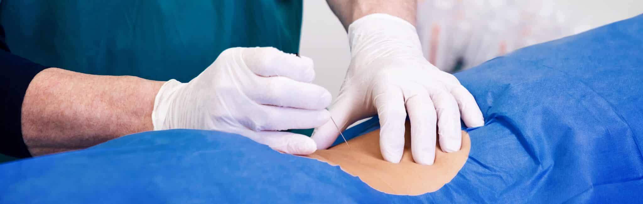 combien temps entre deux infiltrations | Dr Paillard | Paris